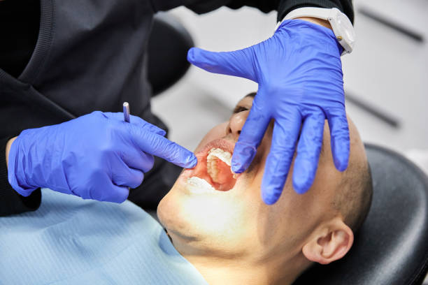 Best Emergency Tooth Extraction  in Zillah, WA
