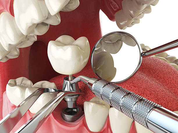 Best Urgent Tooth Repair  in Zillah, WA